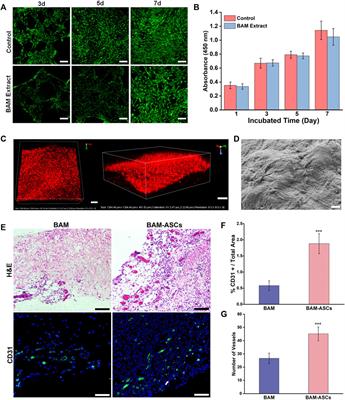 Bladder Acellular Matrix Prepared by a Self-Designed Perfusion System and Adipose-Derived Stem Cells to Promote Bladder Tissue Regeneration